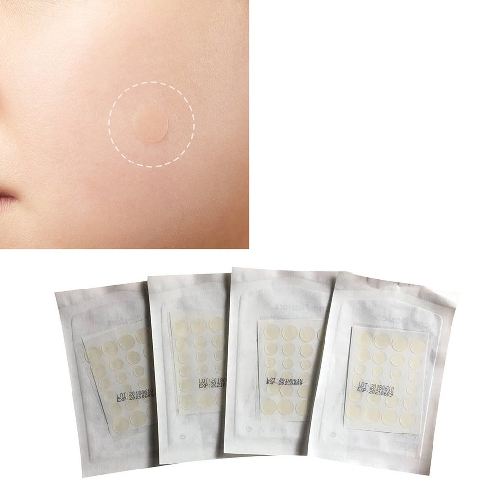 Acne patches
